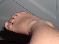 leg-hair